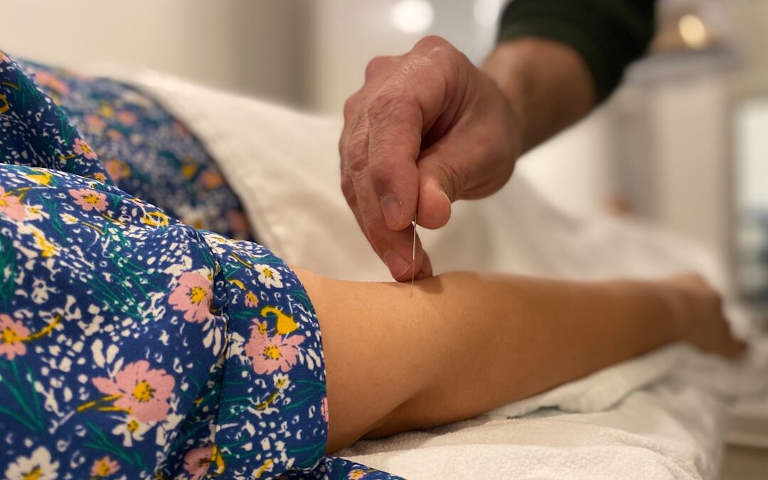 Praticienne utilisant de fines aiguilles stériles lors d’une séance d’acupuncture