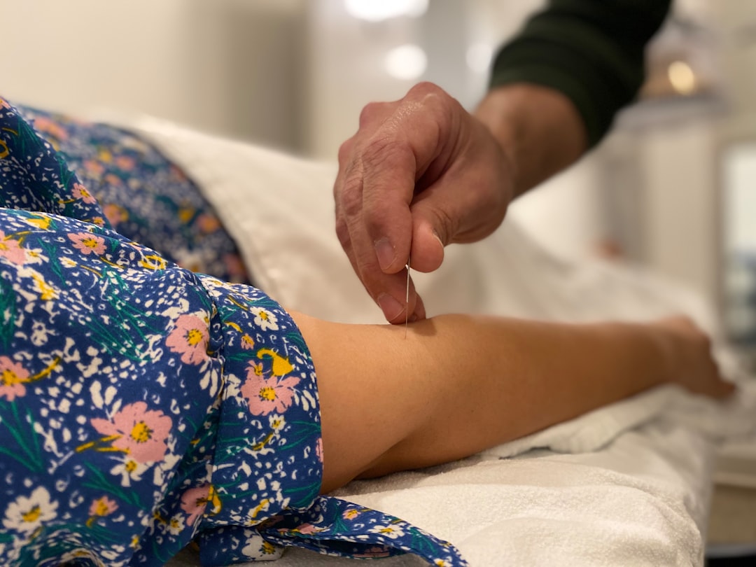L&rsquo;acupuncture pourquoi pour qui?